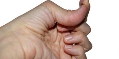 فرط المرونة .. علامة جسدية قد تكشف عن خلل داخلي يهدد الرئة - عرب فايف
