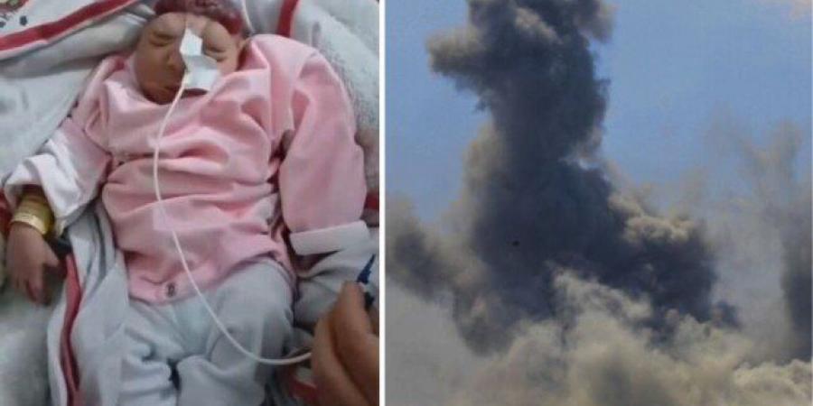 ولادة طفلة بلا دماغ مع تزايد ظاهرة "تشوه الأجنة" في قطاع غزة - عرب فايف