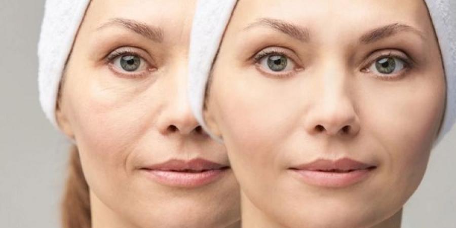 7 أسباب تؤدي إلى انتفاخ الوجه - عرب فايف