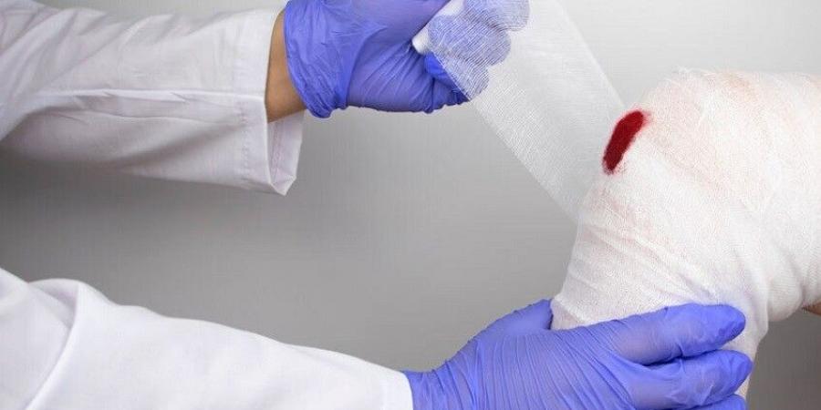 علماء: جروح البشر تلتئم ببطء مقارنة بالثدييات الأخرى - عرب فايف