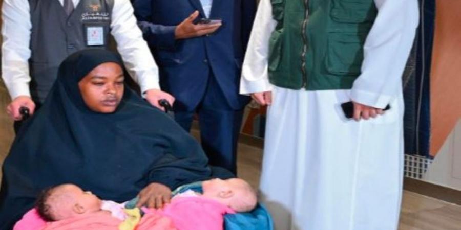 صور| التوأم الملتصق الصومالي "رحمة ورملا" يصلان الرياض لدراسة حالتهما - عرب فايف