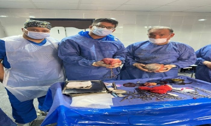 إنقاذ حياة مريضة: نجاح جراحة معقدة في مستشفى قنا العام