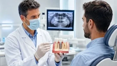الدليل الشامل لتقنية زراعة الأسنان الفورية والخطوات اللازمة والمميزات والشروط والتكلفة