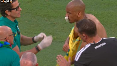 نجم الاتحاد يتعرض لإصابة دامية في مواجهة المغرب والبرازيل